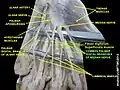 Common palmar digital branches of median nerve